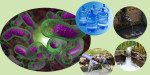 विज्ञ भन्छन्- दिसामा पाइने जीवाणु खानेपानीमा मिसिंदा काठमाडौंमा हैजा फैलियो